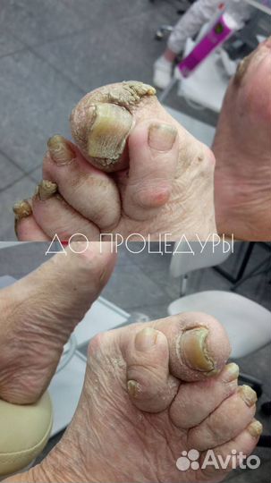 Услуги мастера педикюра, подолог