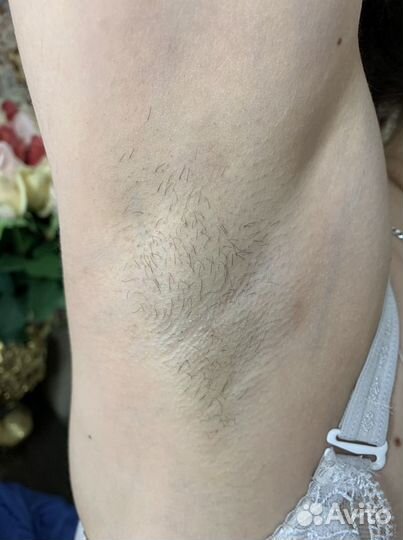 Шугаринг на дому