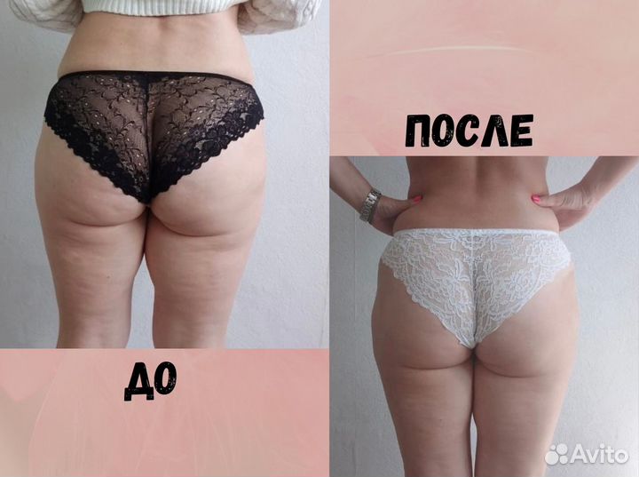 Массаж / Аппаратный массаж / Услуги косметолога