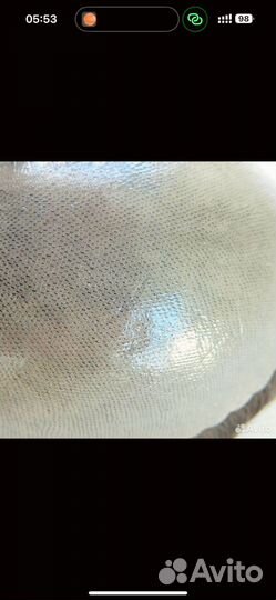 Новая система замещения волос