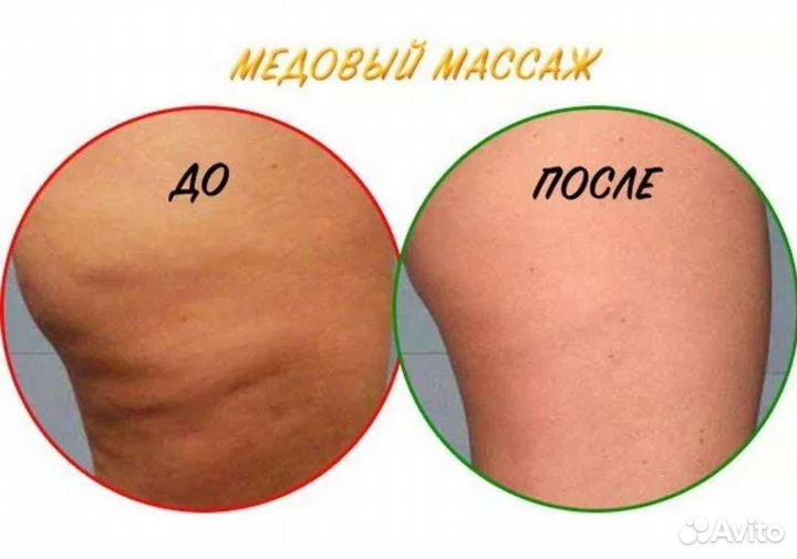Массажист