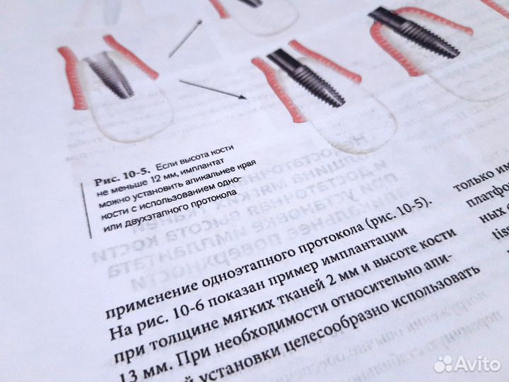 Нулевая утрата кости, Норм качество