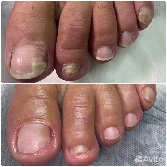 Услуги подолога