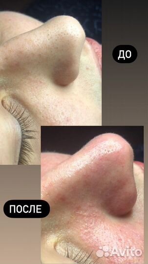 Услуги косметолога