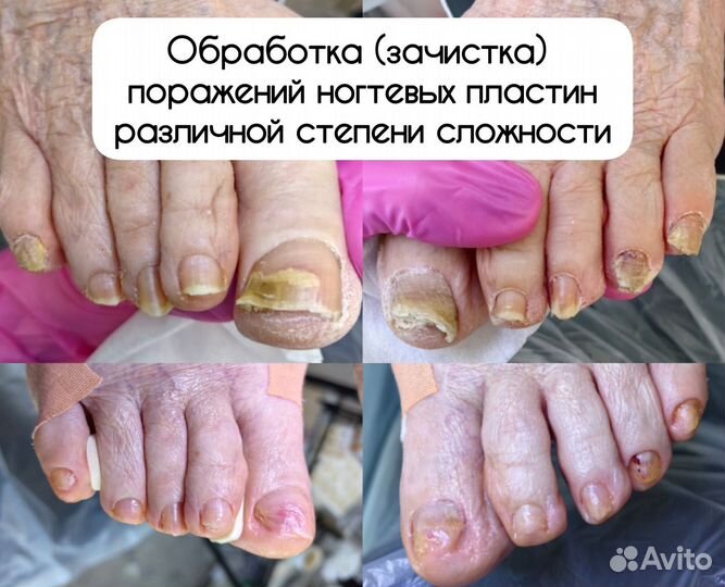 Педикюр с выездом на дом