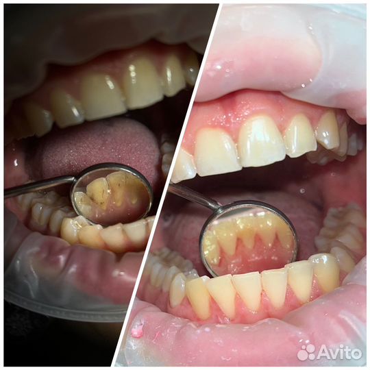 Гигиенист стоматологический