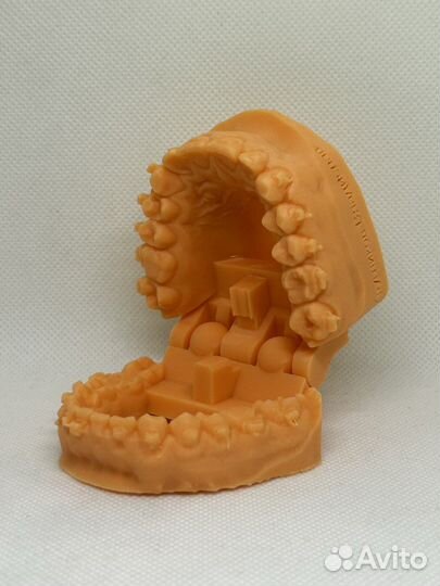 Ортодонтическая 3-D печать