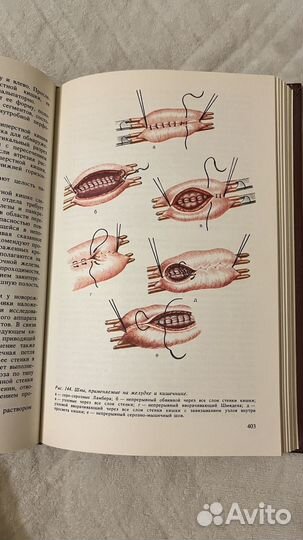 Книга Оперативная хирургия