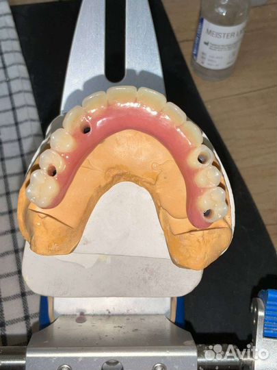 Зубной техник съемное протезирование