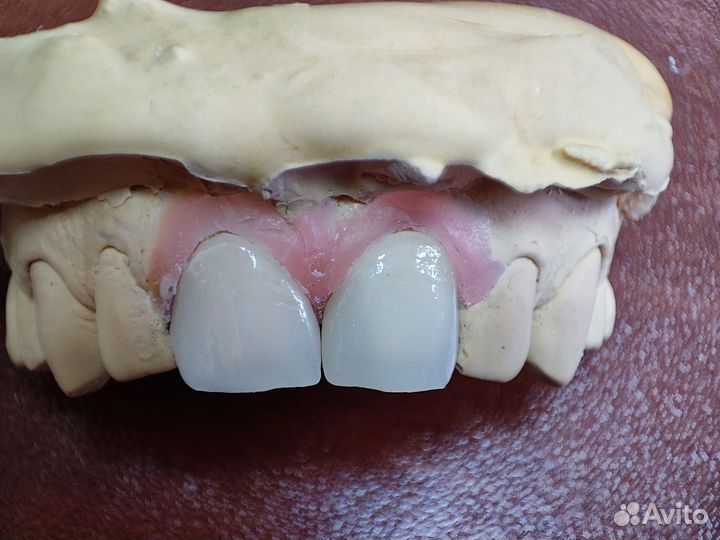 Зуботехнические работы