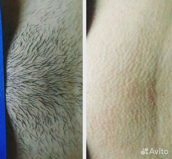 Мужская и женская депиляция воском и сахаром