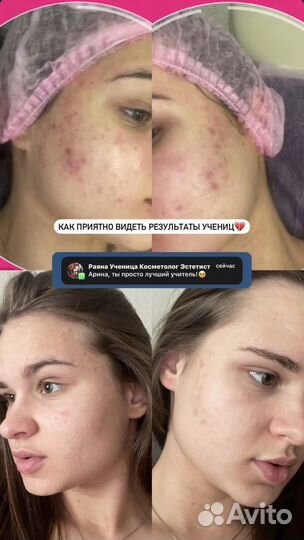 Обучение Косметолог-эстетист