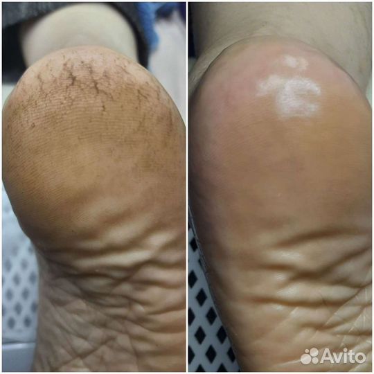 Маникюр педикюр наращивание