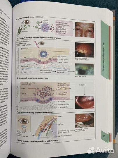 Наглядная аллергология М.Рёкен