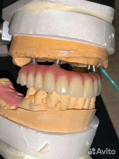 Зубной техник съемное протезирование