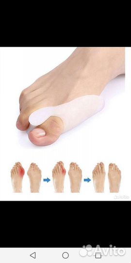 Силиконовый фиксатор большого пальца ноги 2 шт