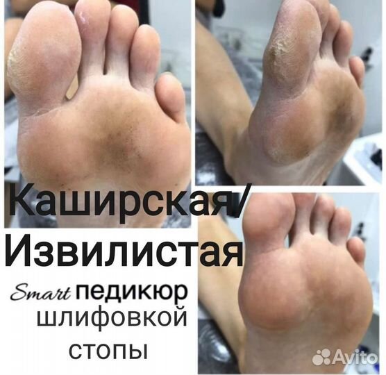 Педикюр, смарт педикюр