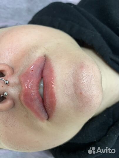 Услуги косметолога