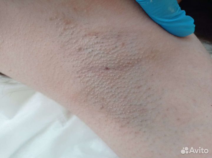 Шугаринг Мужской и женский