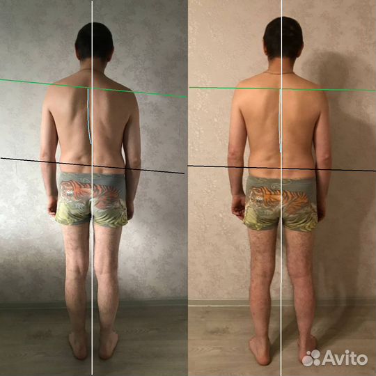 Здоровая спина, снятие болей, остеопат