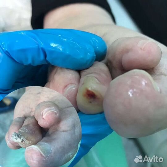 Услуги профессионального подолога