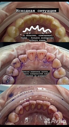 Гигиенист стоматологический