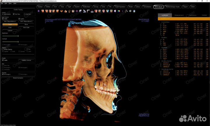 Invivo 7.1.3 2024 года