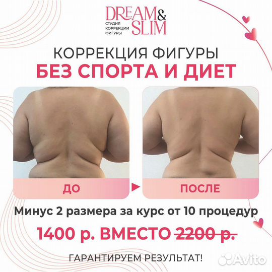 Коррекция фигуры, LPG массаж, RF лифтинг