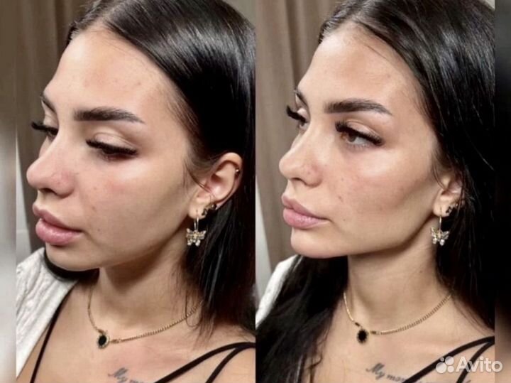 Модель на углы джоли