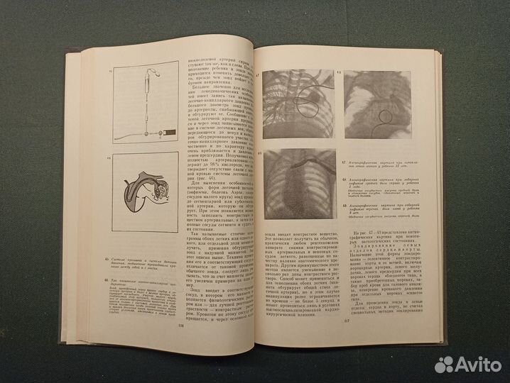 Специальные методы исследования в детской хирургии
