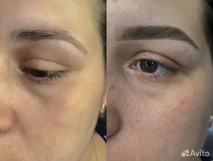 Ламинирование бровей, ресниц