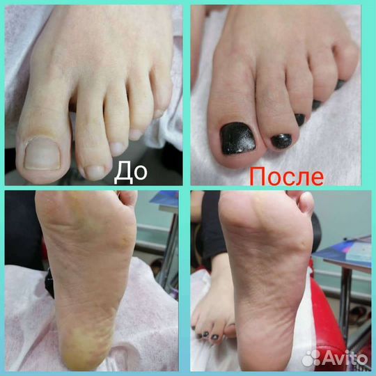 Маникюр и педикюр