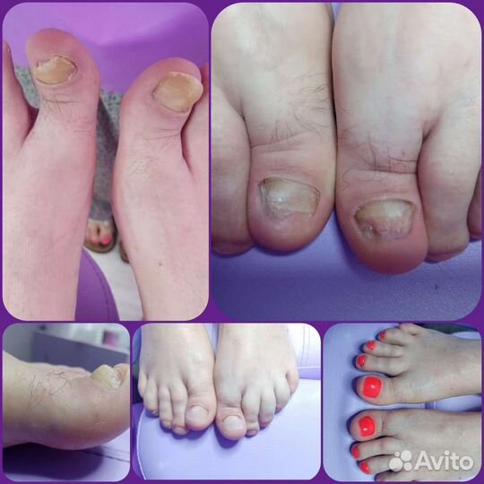 Подолог. Педикюр. Обучение подологии