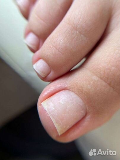 Аппаратный педикюр, комбинированный педикюр