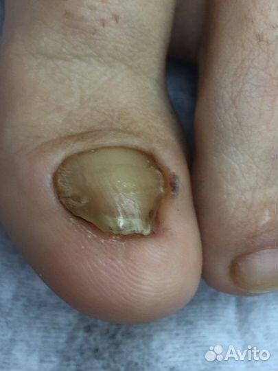 Подолог. Маникюр, педикюр, Наращивание ногтей