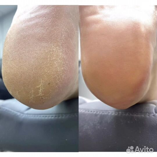 Маникюр, педикюр, наращивание ногтей