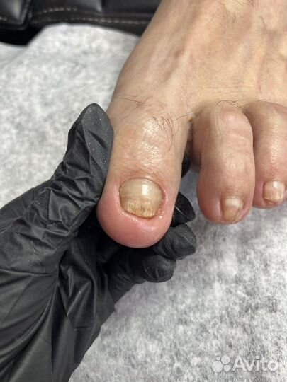 Обучение педикюр, подология Light system