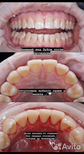 Гигиенист стоматологический