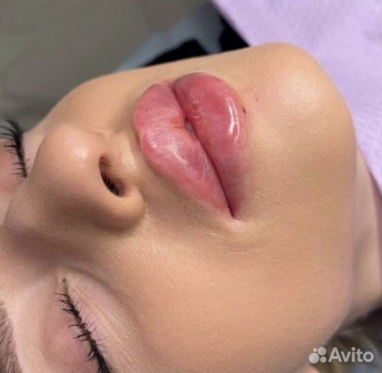 Увеличение губ / обучение