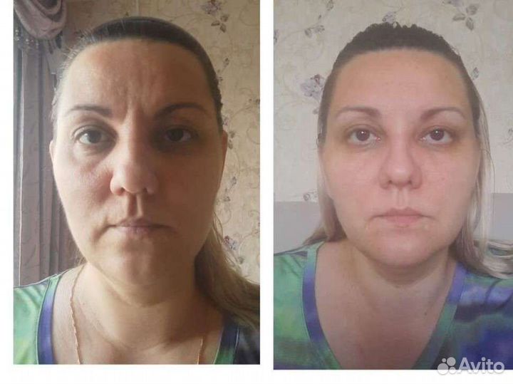 Массаж на дому