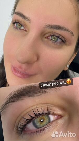 Бровист
