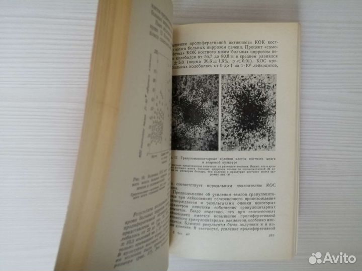 Лейкопении (1981г.) / В. Алмазов