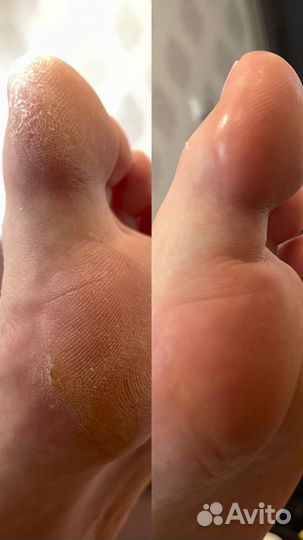 Маникюр и Педикюр с выездом домой