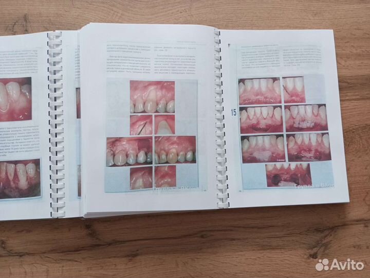 Пластическая хирургия мягких тканей