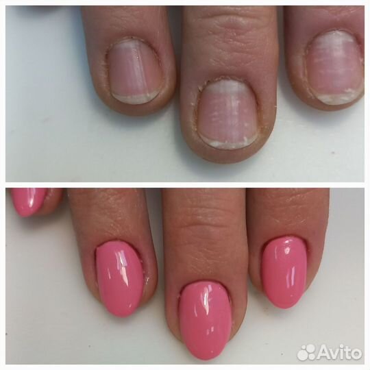 Маникюр SMART педикюр