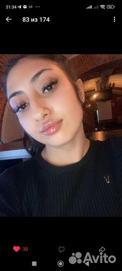 Увеличение губ,мезотерапия лица