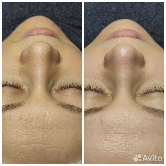 Услуги косметолога. Массаж лица