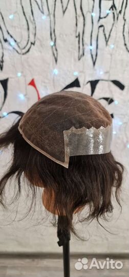 Перефиксация системы замещения волос