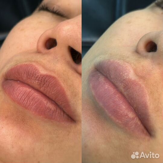 Перманентный макияж (брови, веки, губы)