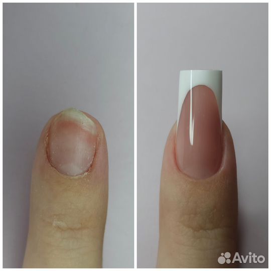 Маникюр педикюр наращивание ногтей